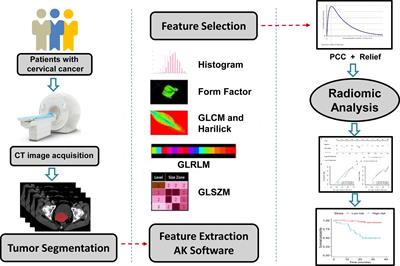 Radiomic Score as a Potential Imaging Biomarker for Predicting Survival in Patients With Cervical Cancer